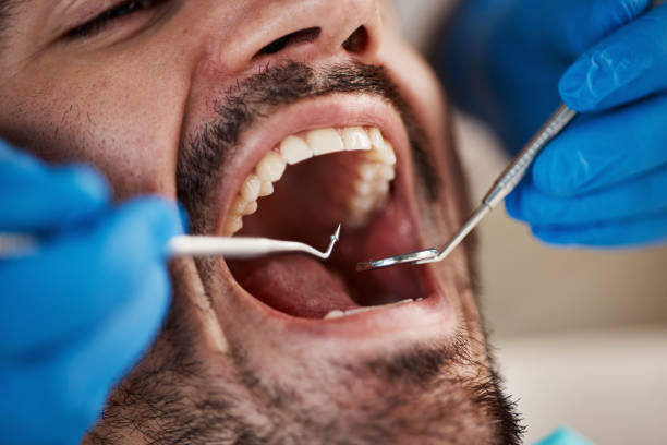 Best Emergency Treatment for Oral Infections in Caledonia, MI